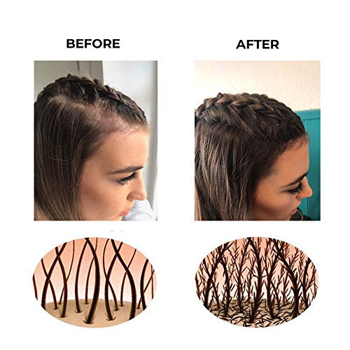 Obojena vlakna za zgušnjavanje kose Keratech Pro 12ml / trenutno punija i gušća kosa / napredna prirodna keratinska formula / odgovara vašoj boji kose