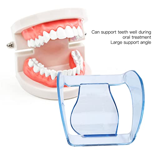 Uvlačenje obraza za izbjeljivanje zuba, zubni otvarač za usta profesionalni otvarač za usta za prednje