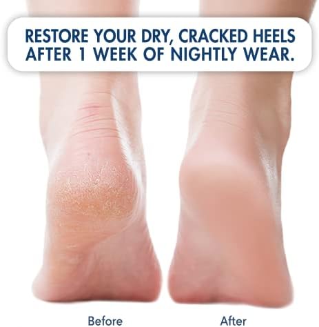 Originalne hidratantne čarape za petu dr. Fredericka za tretman ispucale pete - 2 para-zaustavite